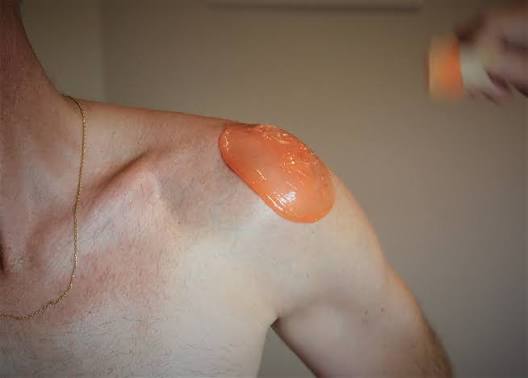 Epilation Epaule image